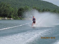 Do your research and select the best surgeon possible – like I did.