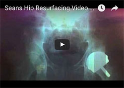 Not a day goes by that I don't think about how great it is to be pain free!